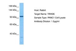 TRH-degrading Ectoenzyme/TRHDE Rabbit anti-Human, Polyclonal, Novus Biologicals